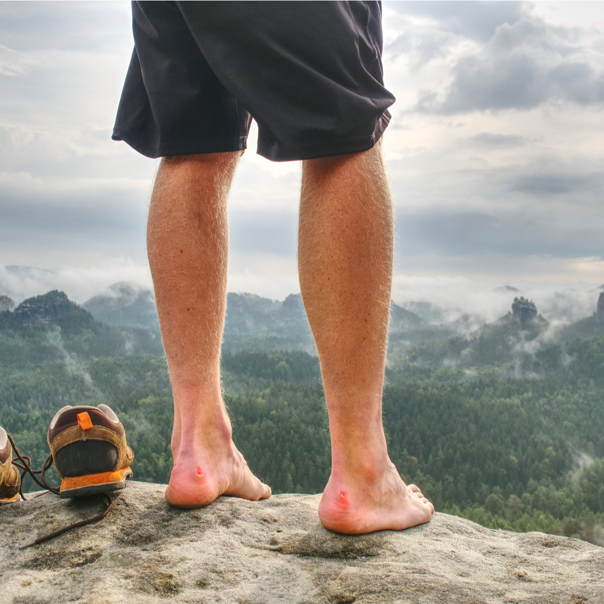 How to Prevent Blisters When Hiking